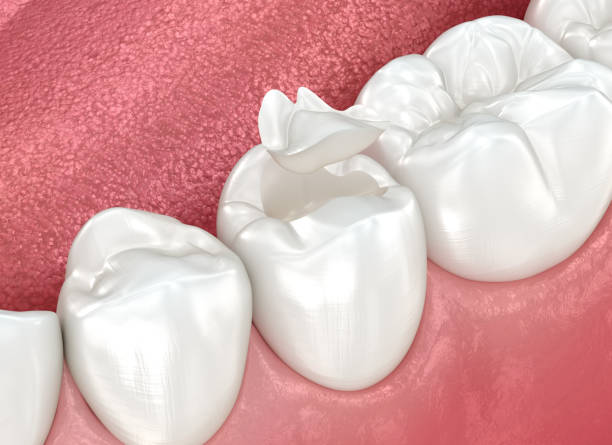 Best Cosmetic Dentistry  in Bolivar Peninsula, TX