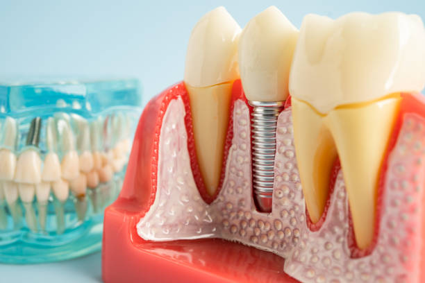 Best General Dentistry  in Bolivar Peninsula, TX